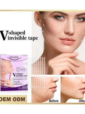  چسب زاویه فک